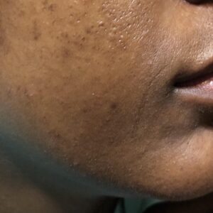 Combination skin