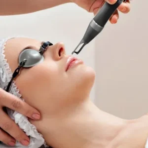 Laser treatments