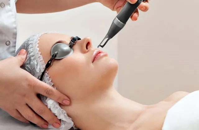 Laser treatments