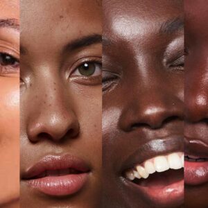 Skin types