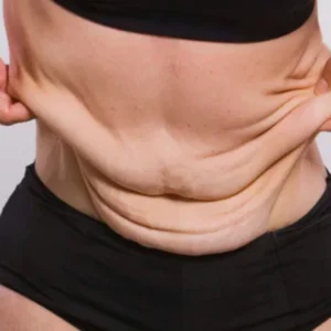 Weight loss