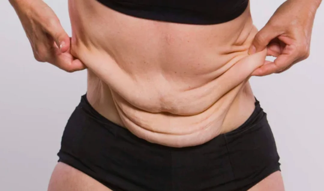 Weight loss